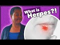 What Is Herpes What Is Herpes