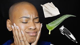 Hey loves! today i???m just showing you guys how a few days after
shaving my head bald, i am experiencing razor burn and what can do to
prevent treat i...