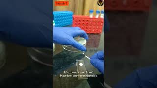 Oxidase Test Biochemical Microbiology Lab Basics Biology Think Vision