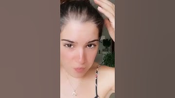 Thumbnail of How to Hide & cover thinning hair for women by using HAIR FIBERS