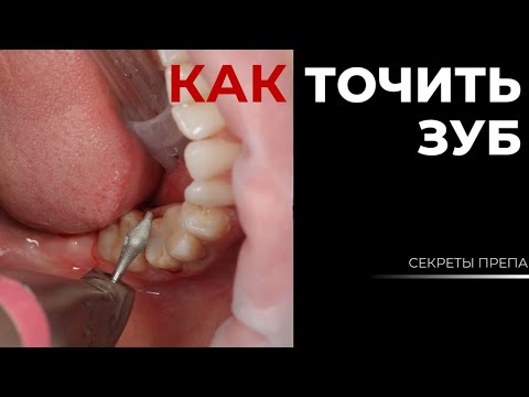 ОРТОПЕДИЯ преп и временная коронка
