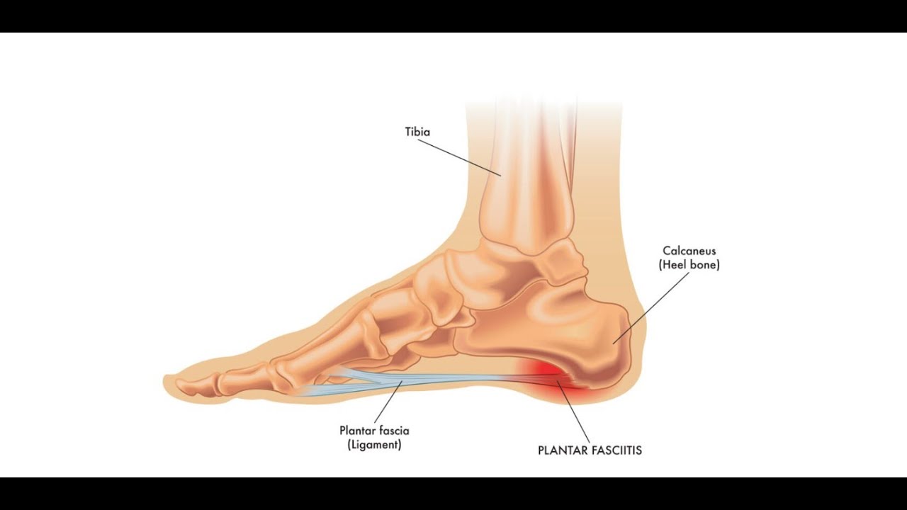 Kantakalvon ja nilkan teippaus