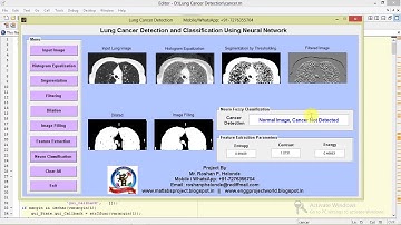 Lung Cancer Detection and Classification Using Neural Network Matlab Project Code || IEEE Project