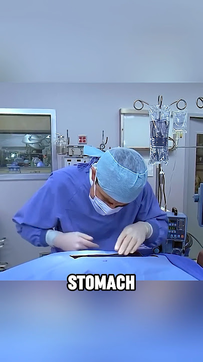 He Took a Risk and Actually Saved The Patient 😂 #shorts