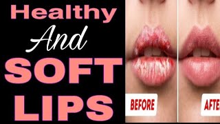 Lip care || Healthy and useful tips to take care of your lips || Get soft and pink lips screenshot 5
