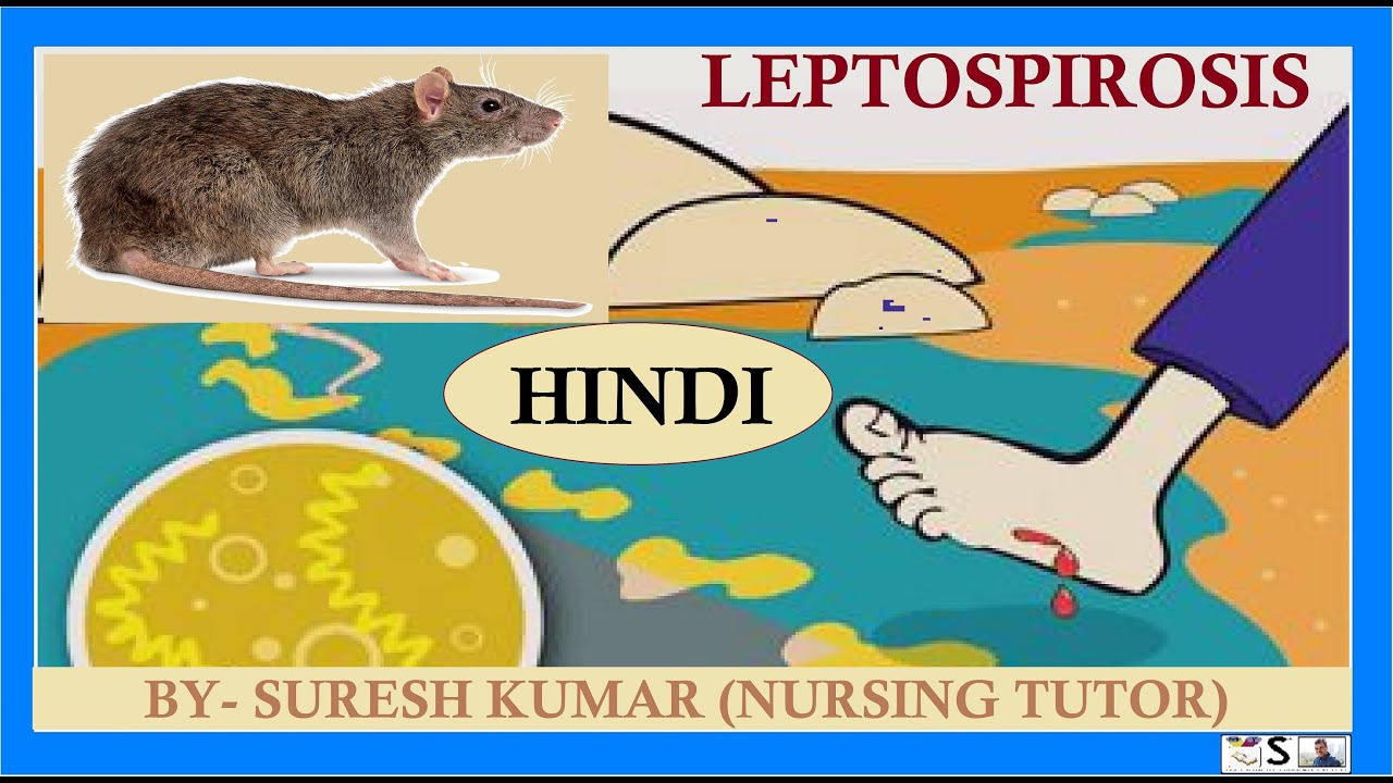 लेप्टोस्पायरोसिस क्या है? | LEPTOSPIROSIS IN HINDI | चूहों से होने वाले रोग