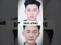 Scar-sparing SMAS with subtle lifting effect. #AntiAgingTreatment #faciallifting