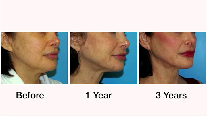 Fab At Any Age: Cosmetic Surgeon Dr. Giese and the...