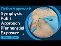 Orthoapproach  symphysis pubis approach  pfannenstiel exposure