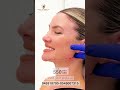 تقنية تيكساس للحصول على مظهر اكثر ثقة وجمالاً #تجميل_دبي #beauty #uae #دبي#الامارات