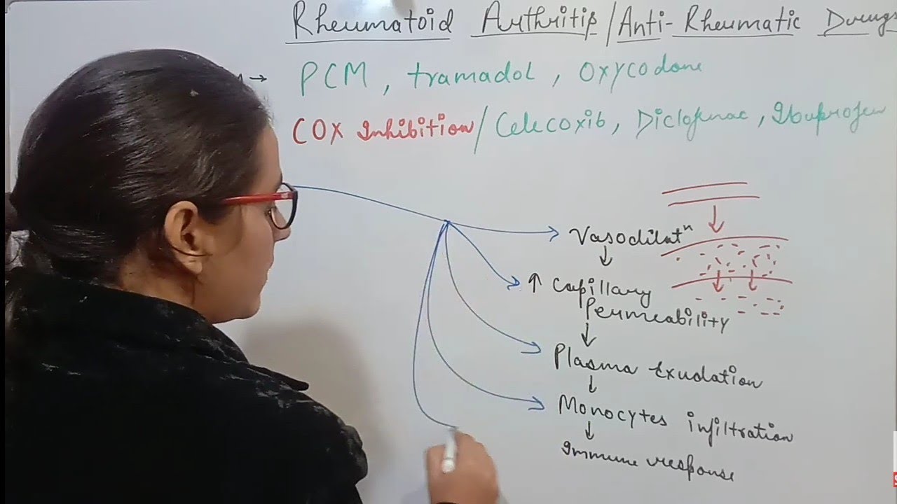 RHEUMATOID ARTHRITIS | TREATMENT | ANTIRHEUMATIC DRUGS