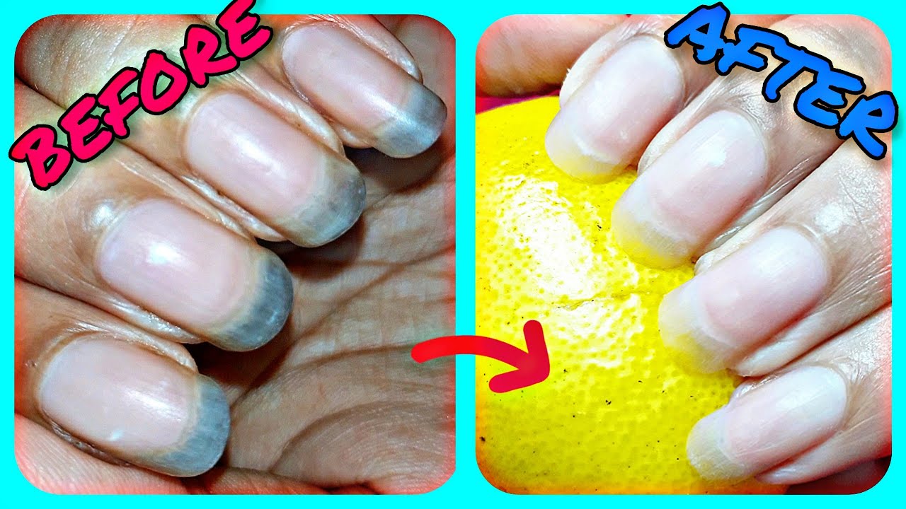 Keeping Your Nails Clean And Stain-Free