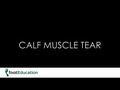 Calf Muscle Tear