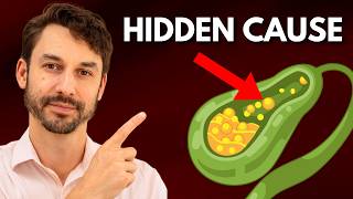 The big gallbladder mistake that leads to SURGERY (700,000 a year)