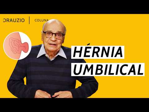 Umbilical hernia