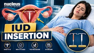 How Is an IUD Inserted | Step-by-Step Medical Animation
