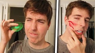 Fidget Spinner Vs Face (Legit Had To Get Stitches)