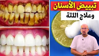 تبييض الأسنان وعلاج اللثة بوصفات طبيعية الدكتور عماد ميزاب Docteur Imad Mizab @lapetitemaison