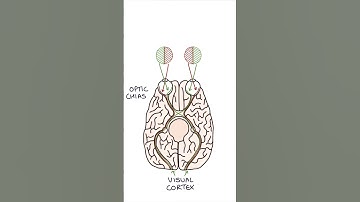 Bitemporal Hemianopia #medicine #clinicalexamination #ophthalmology