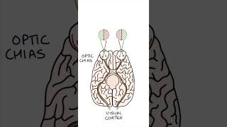 Bitemporal Hemianopia #medicine #clinicalexamination #ophthalmology