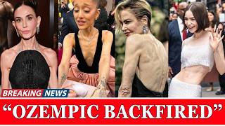 Information 16 Celebs Suffering From Ozempic Face | Before & After 2026 Guide