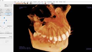 Demo Invivo (Anatomage) Vídeo 03