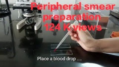 Differential Leucocyte Count (DLC) | practical #mbbs #physiology #haematology