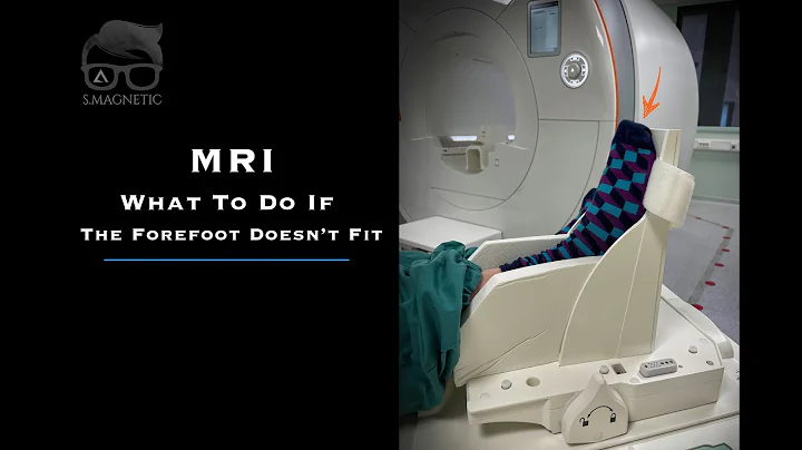 MRI – What To Do If The Forefoot Doesn’t Fit - 天天要聞