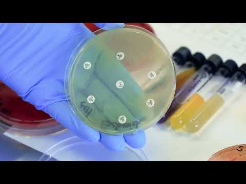 Video: ¿Todas las enterobacterias oxidasa son negativas?