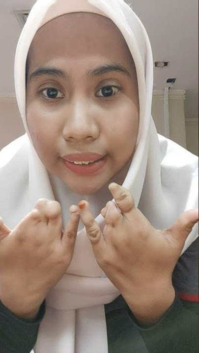 Saya Prima Cipta Annisa, anak penyandang disabilitas dengan cacat fisik pada tangan kanan dan kiri