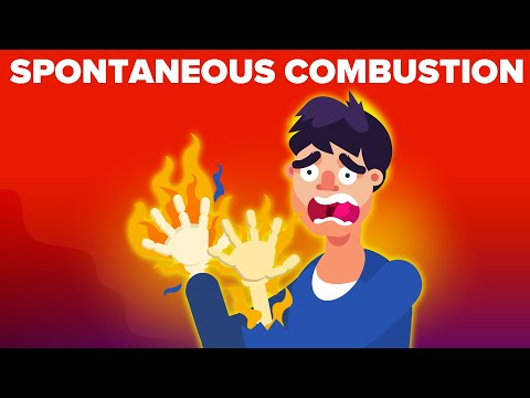 Video: Intestinal Gases As A Cause Of Spontaneous Combustion Of A Person - Alternative View