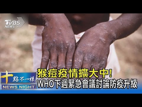 猴痘疫情擴大中! WHO下週緊急會議討論防疫升級｜十點不一樣20220615