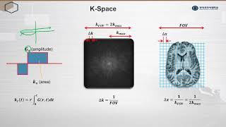 Magnetic Resonance Imaging - MRI K Space