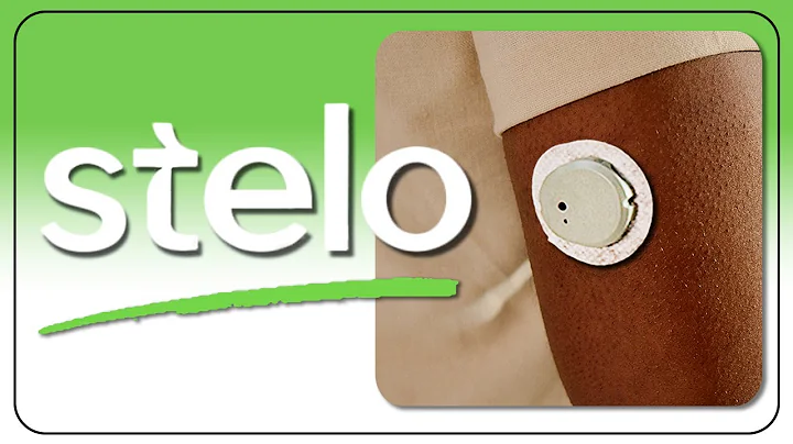 New Dexcom Stelo CGM & G7 Updates - I Asked Your Questions
