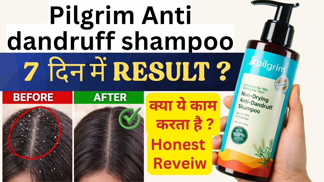 Pilgrim Anti Dandruff Shampoo | Pilgrim anti drying anti dandruff Shampoo | REVEIW