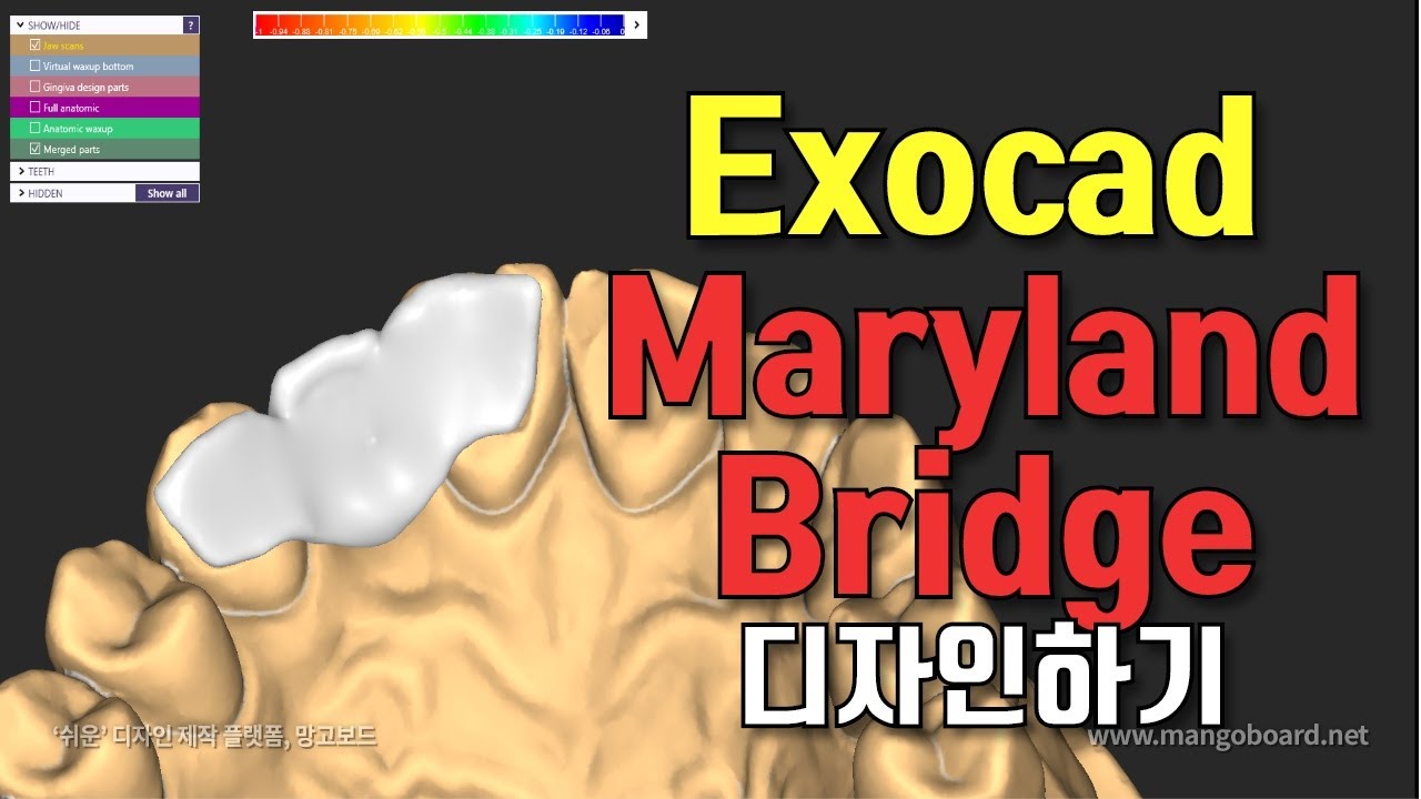 Exocad Maryland Bridge Design (엑소캐드 매릴랜드 브릿지 디자인 방법) YouTube
