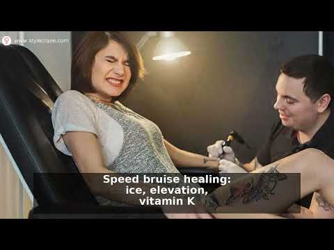 Can You Tattoo Over a Bruise? Risks & Healing Tips
