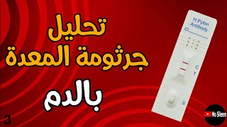 تحليل الاجسام المضادة لجرثومة المعدة في الدم 🦠 H pylori Ab