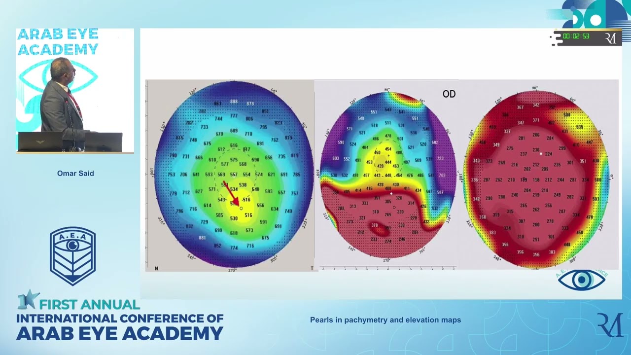 Pearls in pachymetry and elevation maps, Dr. Omar Said