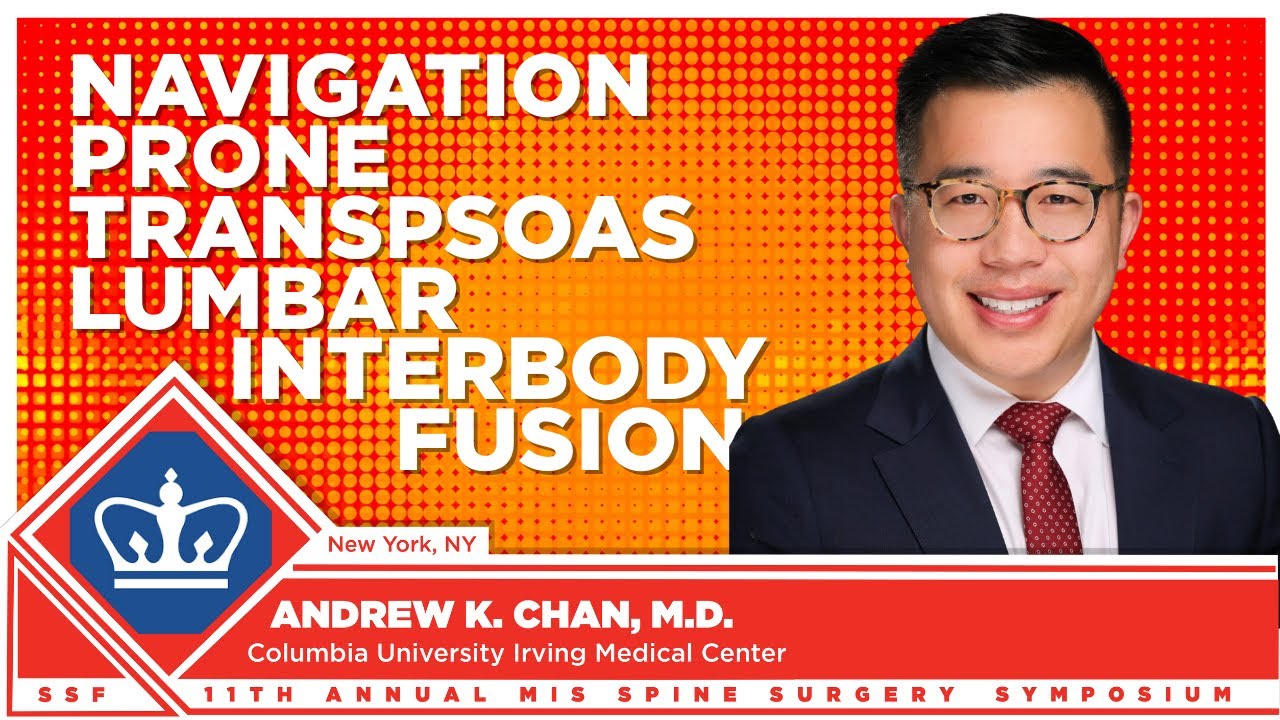 Navigation Prone Transpsoas Lumbar Interbody Fusion - Andrew K