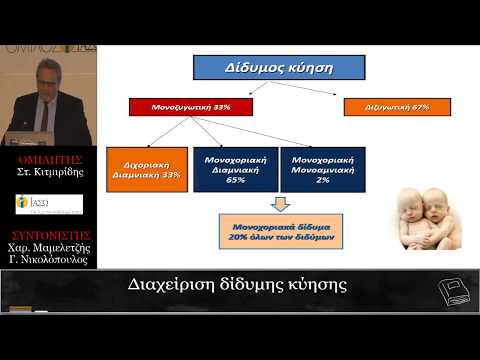 Διαχείριση δίδυμης κύησης - Στέλιος Κιτμιρίδης