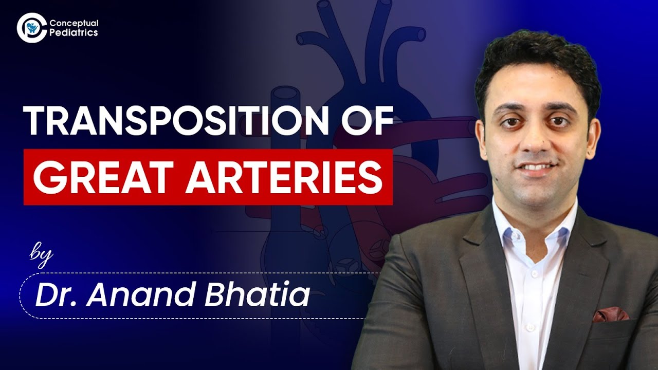 Transposition of Great Arteries by Dr. Anand Bhatia