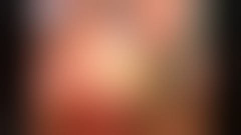 Laparoscopic cholecystectomy totally by hook dissection by prof Mohammad Hamdy Abo-Ryia