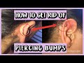 HOW TO GET RID OF PIERCING BUMPS