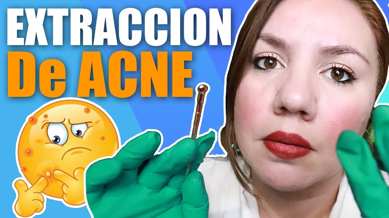 ASMR Dermatologist: Exam and Extractions RoIePIay jonie kondracki