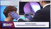 Ulat Resdung Keluar Dari Muka Treatment Face Youtube