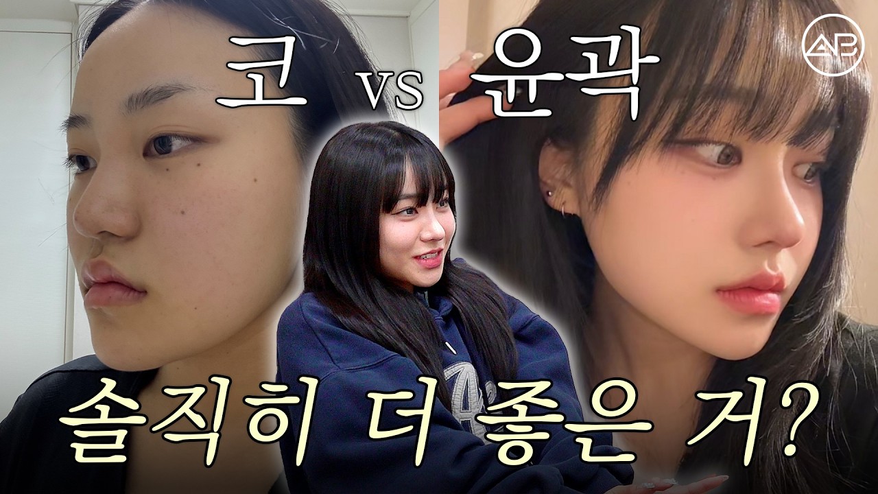 광대 가리는 웨이브 머리 탈출! 남상 고민 지우고 슬릭컷 자신감 찾은 안면윤곽+코수술 리얼 후기 💇♀️✨ | 비포애프터⭕| 에이비성형외과