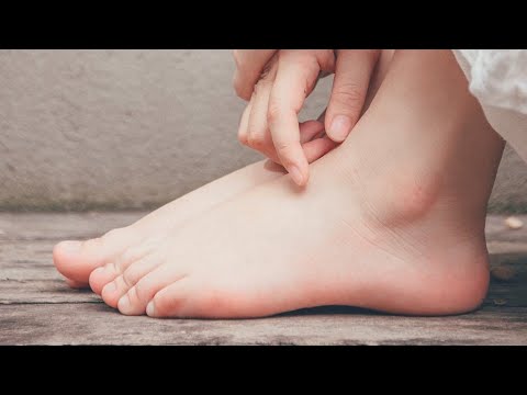 Video: Uzroci I Liječenje Zadebljalog Hiponihija (koža Ispod Nokta)