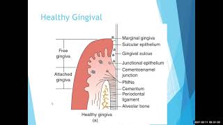 DNH 146 Chapter 8 Periodontisi and other perio conditions