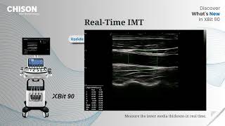 Download Lagu CHISON XBit90 MP3